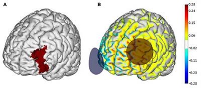 Transcranial Direct Current Stimulation May Reduce Prefrontal Recruitment During Dual Task Walking in Functionally Limited Older Adults – A Pilot Study